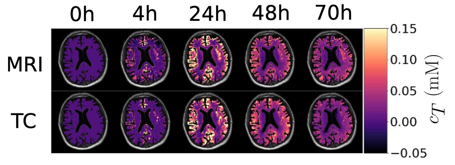 Comparison of two-compartment model results vs MRI data